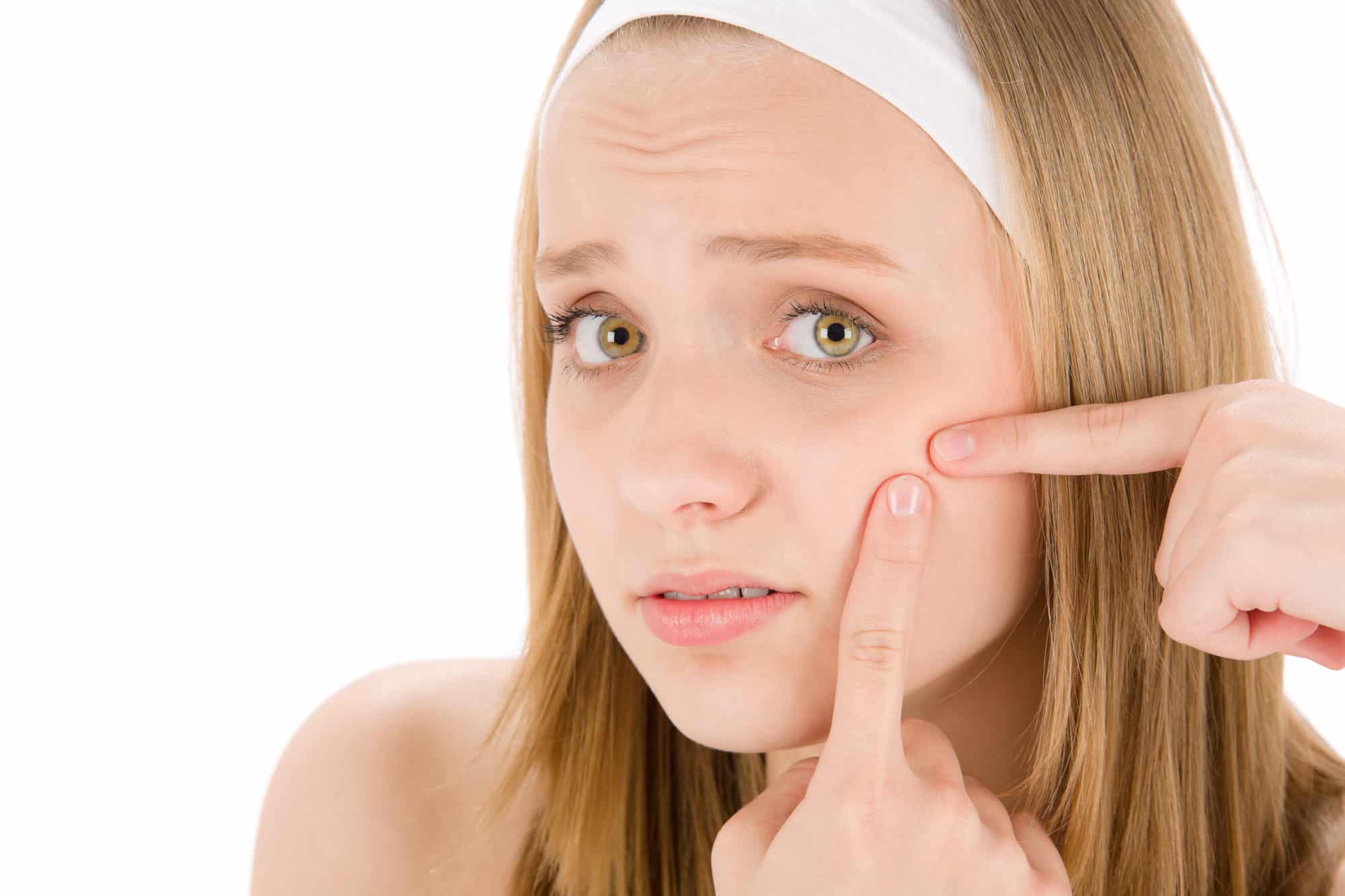 Acne in Teenagers | Short Hills Dermatology