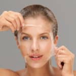 What is a Chemical Peel?