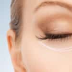 Does Botox Treat Eye Wrinkles?