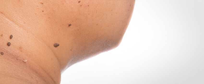 Services_SkinCancer Services_SkinCancer