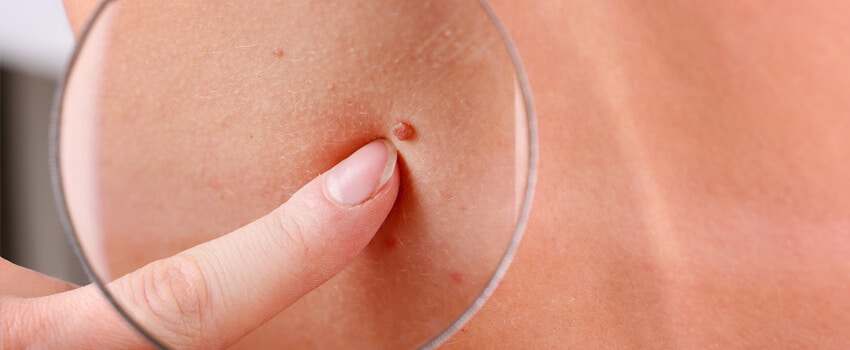 Services_SkinCancerFacts Services_SkinCancerFacts