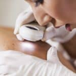 dermatologist examines for skin cancer
