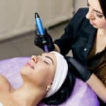 Woman receiving microneedling treatment on her face from a technician.