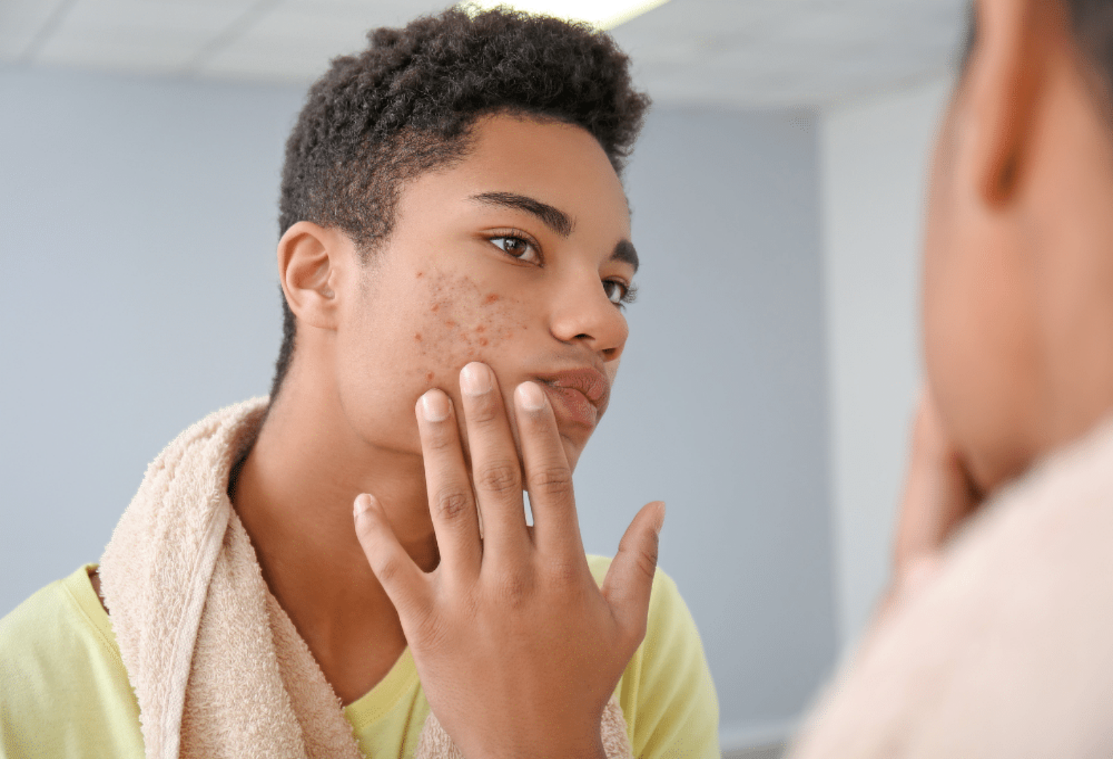 Exploring Effective Acne Treatments For Teenagers   Acne Treatments For Teenagers Qboie0n39cysboenew1nj295vhrrt2dygvw2v968mo 