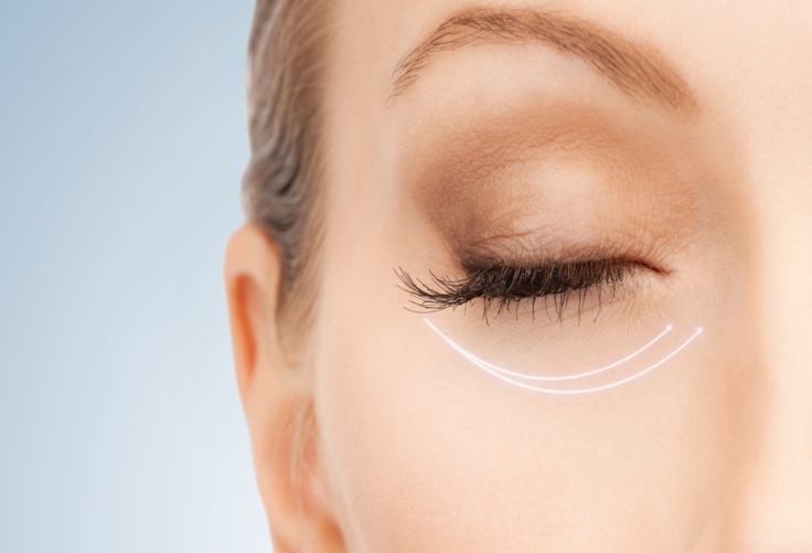 Where is Restylane® Used? | Short Hills Dermatology